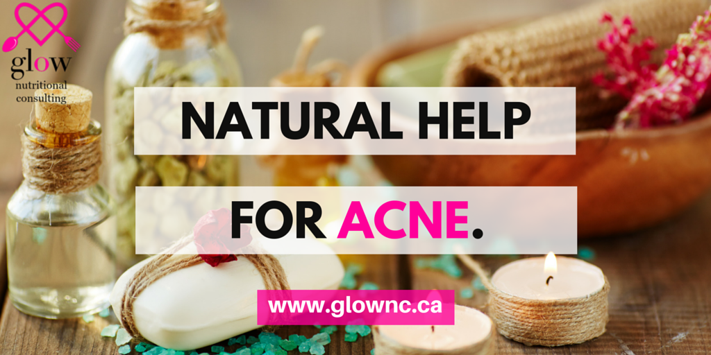 Natural Help for Acne